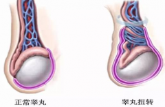 怎样补睾丸?-泉州男科医院